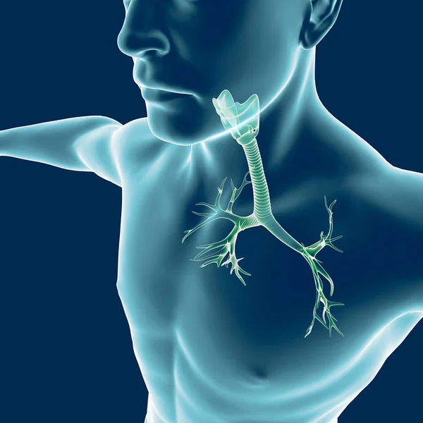 Bronchi, the human body, man, lungs, inflammation — Stock Photo, Image