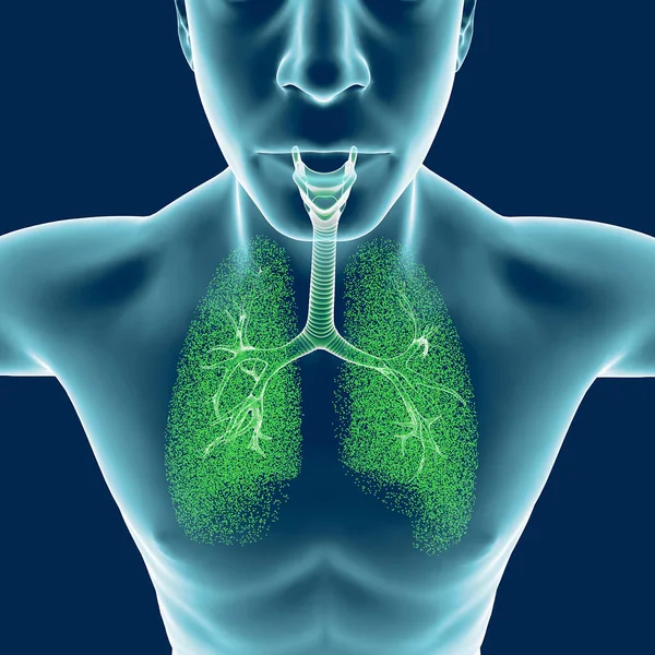 Bronchi, the human body, man, lungs, inflammation — Stock Photo, Image