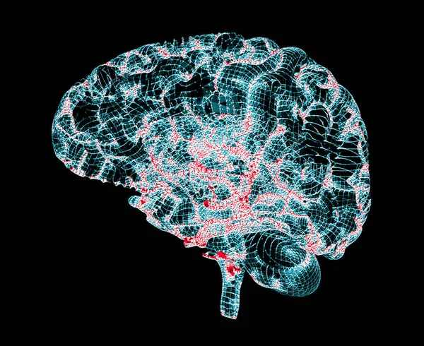 Brain degenerativa sjukdomar, Parkinson, Alzheimer's, 3d-rendering — Stockfoto