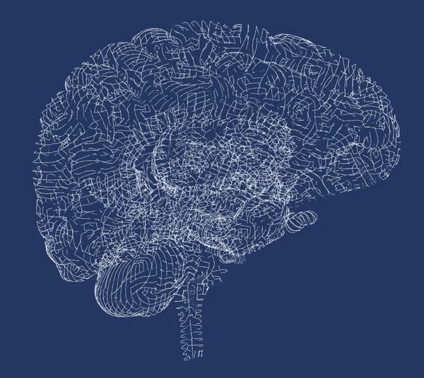 Brain degenerative diseases, Parkinson, synapses, neurons, Alzheimer's, 3d rendering — Stock Photo, Image