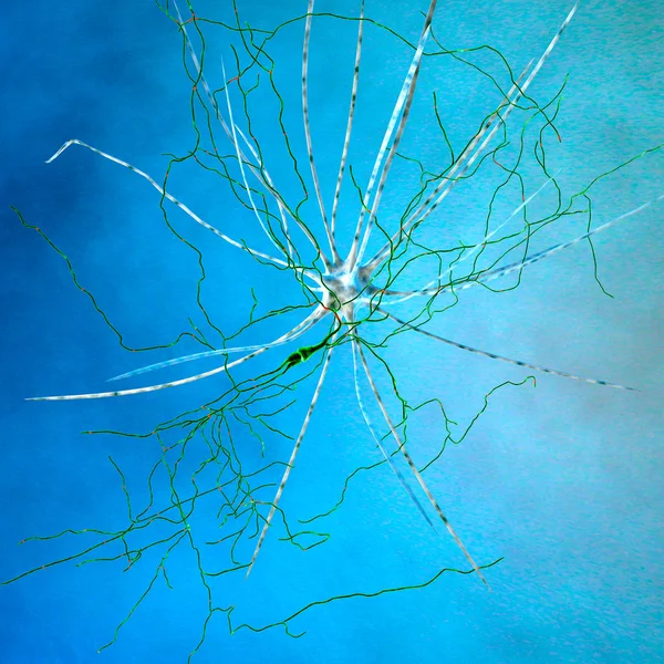 Hjärnan, nervceller, synapser, neurala nätverk krets av nervceller, degenerativa sjukdomar, Parkinsons — Stockfoto