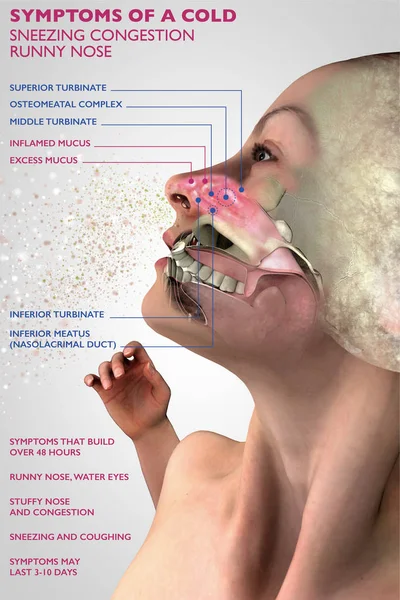 Symtom på en kall, människans anatomi, 3d avsnitt av ett ansikte, flicka med kallt. Pollen allergi. 3D-rendering — Stockfoto