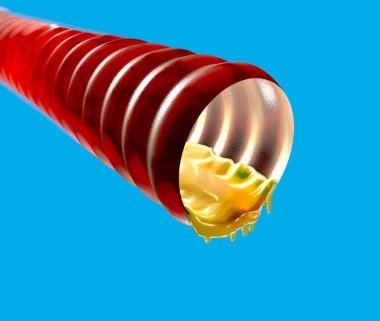Trachea with mucus, catarrh, 3d section. Duct that serves to transfer the air from the outside to the lungs. 3d rendering clipart