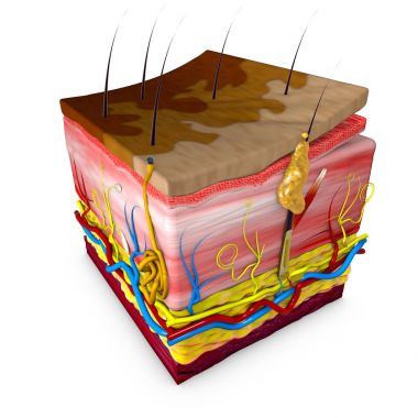 Tinea versicolor is a condition characterized by a skin eruption on the trunk and proximal extremities. Skin section. Rendering in 3d clipart