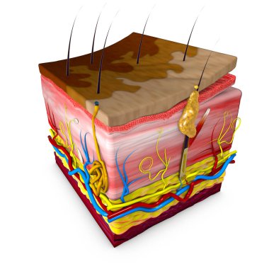 Tinea versicolor is a condition characterized by a skin eruption on the trunk and proximal extremities. Skin section. Rendering in 3d clipart