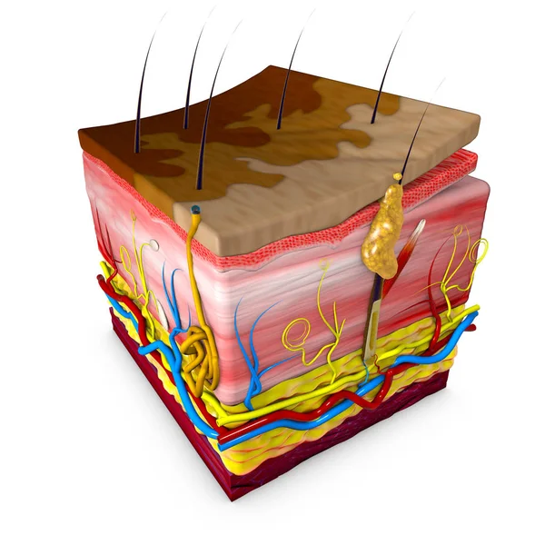 Tinea versicolor est une affection caractérisée par une éruption cutanée sur le tronc et les extrémités proximales. Coupe de peau. Rendu en 3d — Photo