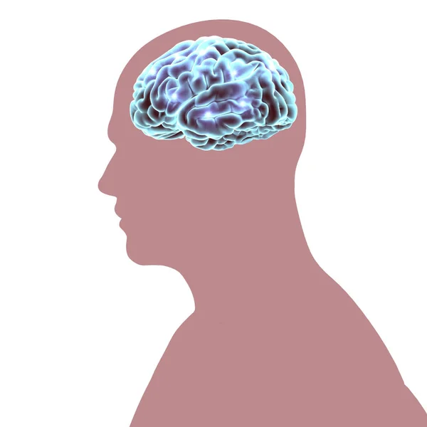 Cerebro Enfermedades Degenerativas Alzheimer Parkinson Cuerpo Humano Cara Renderizado — Foto de Stock