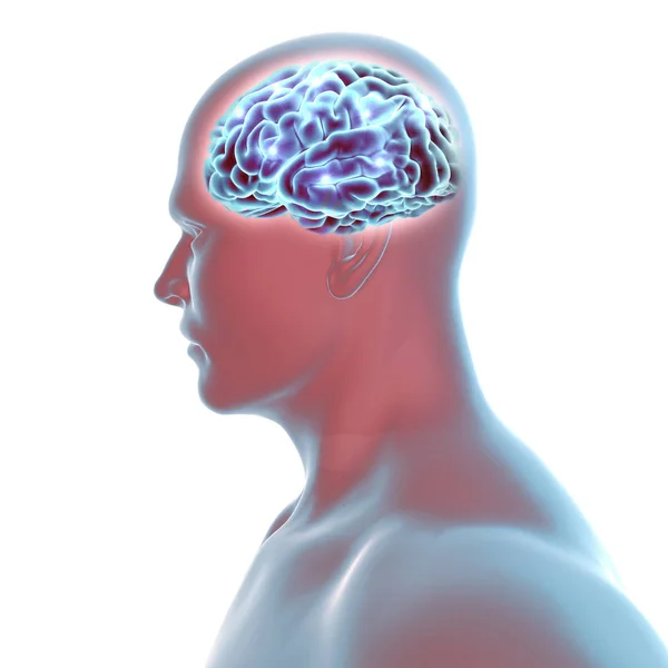 Cérebro Doenças Degenerativas Alzheimer Parkinson Corpo Humano Rosto Renderização — Fotografia de Stock