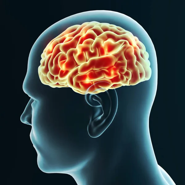 Cerebro Enfermedades Degenerativas Alzheimer Parkinson Cuerpo Humano Cara Renderizado — Foto de Stock