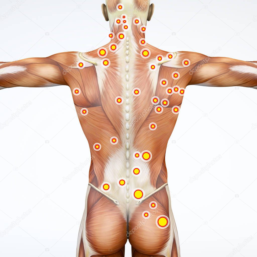 Back view of a man and his trigger points. Anatomy muscles. 3d rendering. Myofascial trigger points, are described as hyperirritable spots in the fascia surrounding skeletal muscle. Palpable nodules in taut bands of muscle fibers