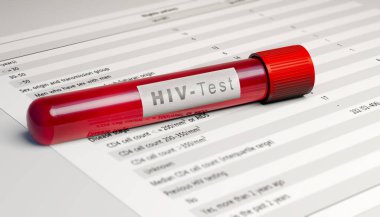 HIV virüsü testi, kan tüpü. Virüs sana da bulaştı mı diye analiz et. AIDS. İnsan bağışıklık yetmezliği virüsleri, 3 boyutlu görüntüleme