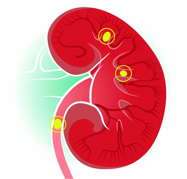 Vista Del Corpo Umano Dei Reni Reni Sono Due Organi — Vettoriale Stock