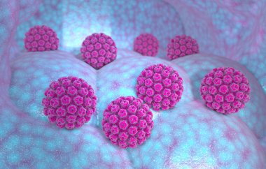 İnsan papillomavirüs enfeksiyonu. Virüs. HPV dünya çapında cinsel yolla bulaşan en yaygın enfeksiyondur. HPV enfeksiyonuna papillomavirus ailesinden bir DNA virüsü olan insan papillomavirus neden olur.