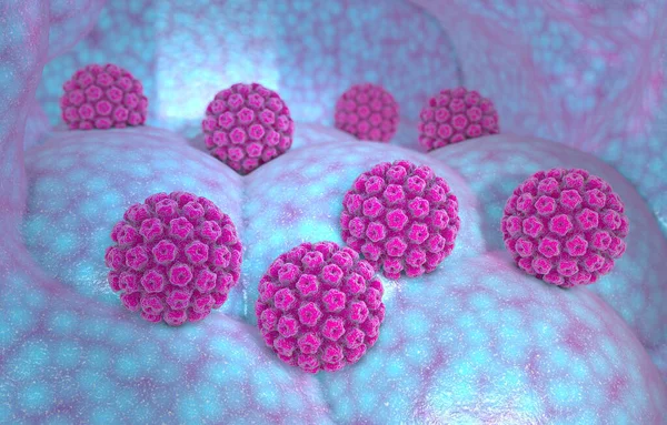 Infección Por Virus Del Papiloma Humano Virus Vph Infección Transmisión —  Fotos de Stock