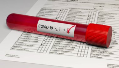 Covid-19 test tüpü, temiz bez ve temiz bez. Örnek alın, bulaşıcı hastalık ve koronavirüs enfeksiyonu. 3d hazırlayıcı
