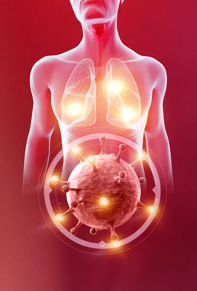 Radiografia Corpo Humano Dos Pulmões Traqueia Coronavírus Vírus Que Ataca — Fotografia de Stock