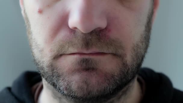 Hombre Con Máscara Facial Protección Médica Con Palabra Coronavirus Cerca — Vídeo de stock