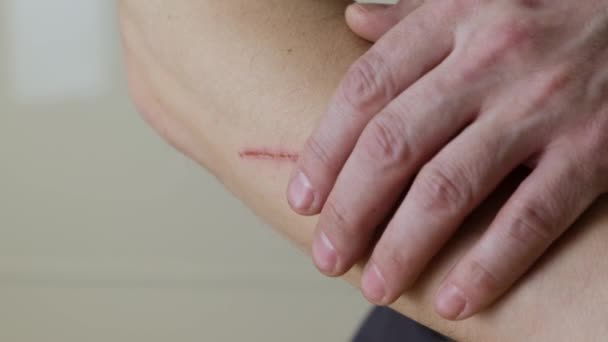 Man touches a scratch on his hand. Close up. — Stock Video