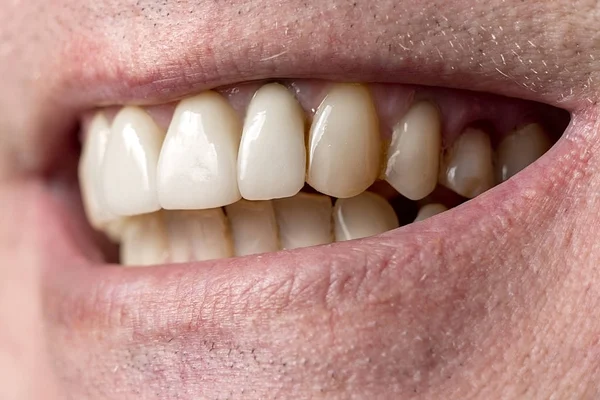 Sonrisa de cerca de un hombre sin afeitar. Vista lateral — Foto de Stock