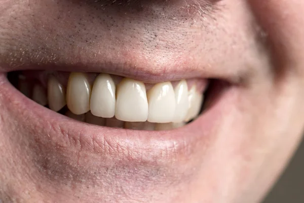 Een glimlach van dichtbij van een ongeschoren man. Zachte focus — Stockfoto