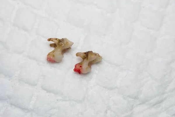Beyaz sörfte tartarlı köpek dişlerinin yakın plan fotoğrafı. — Stok fotoğraf