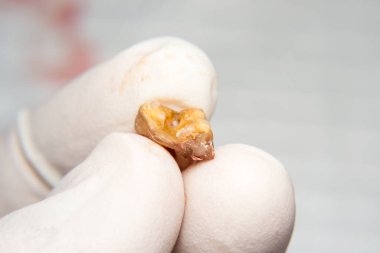 Bakteriyel plakalı köpek dişinin yakın plan fotoğrafı.