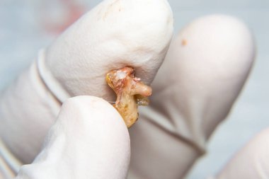 Bakteriyel plakalı köpek dişinin yakın plan fotoğrafı.