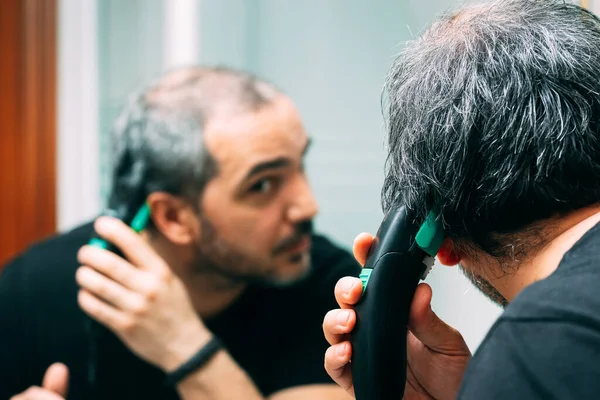 Man Cutting His Hair Electric Haircut — Stock Photo, Image