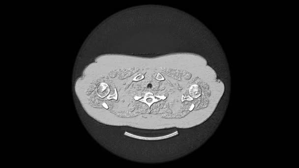 MRI-Scan der Lungen und Bronchien, Diagnose von Atemwegserkrankungen — Stockvideo