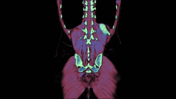 Kleurcontrast MRI van de buikholte, maagdarmkanaal, blaas — Stockvideo