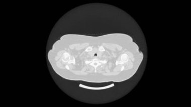 Akciğer ve bronşların MRtaraması, solunum yolu hastalıklarının tanısı