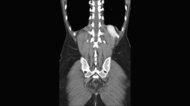 Resonancia magnética de contraste de la cavidad abdominal, tracto gastrointestinal, vejiga — Vídeo de stock
