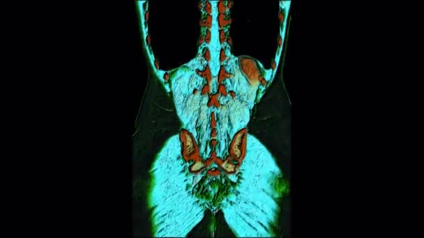 Kontras warna MRI dari rongga perut, saluran pencernaan, kandung kemih — Stok Video