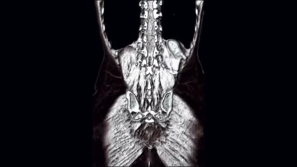 Контрастная МРТ брюшной полости, желудочно-кишечного тракта, мочевого пузыря — стоковое видео