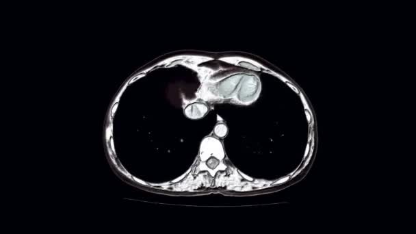 Resonancia magnética de contraste de la cavidad abdominal, tracto gastrointestinal, vejiga — Vídeo de stock