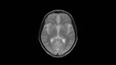Saf MRI beyni, kafa taraması ve tümör tespiti. Teşhis medikal aracı