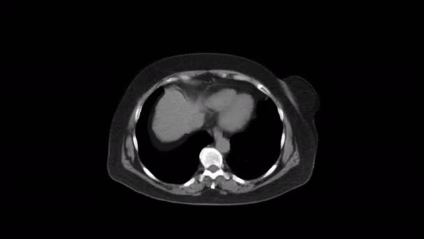 腹腔、消化管、膀胱のMRI — ストック動画