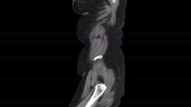 Karın, gastrointestinal bölge ve mesanenin saf MR 'ı.