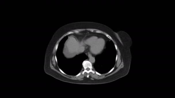 IRM purifiée de l'abdomen, du tractus gastro-intestinal, de la vessie — Video