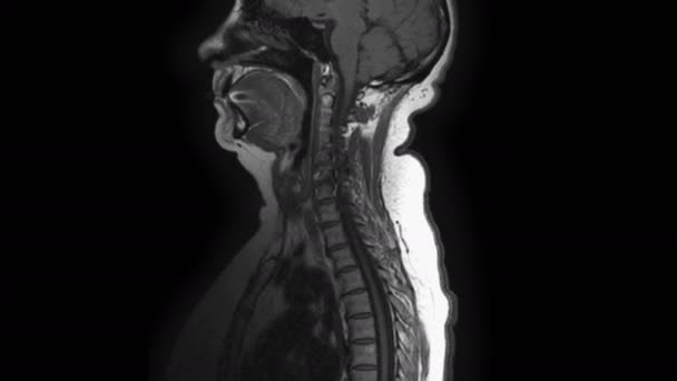 転移の検出のための女性臓器の術後MRI — ストック動画