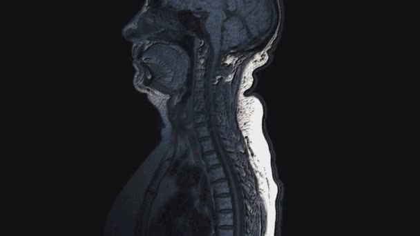 Pooperacyjny tomowy kolor MRI narządów żeńskich do wykrywania przerzutów — Wideo stockowe