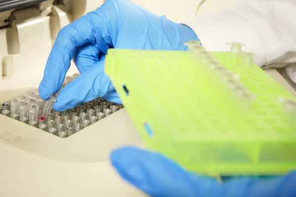 Preparación de muestras para la reacción de análisis de PCR — Foto de Stock