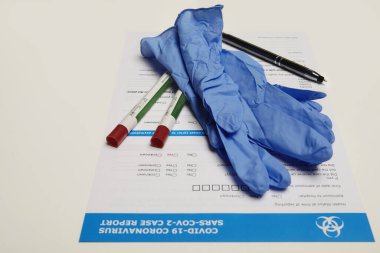 Covid-19 Coronavirus vakasını bildirmek için kullanılan eldiven ve örnek.