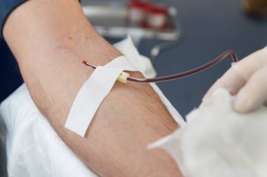 Kan bağışlayan bir adamın kolunu kapat. Erkek donör mobil kan bağışı merkezinde kan veriyor. Koronavirüs pandemisi sırasında destek için bağış, seçici odaklanma. Dünya kan bağışı günü