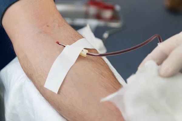 Close up arm of a man who donates blood. Male donor gives blood in a mobile blood donation center. Donation to support during a pandemia of coronavirus, selective focus. World blood donor day