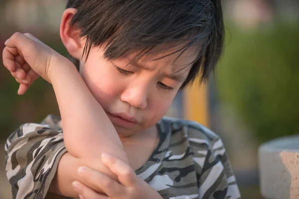 Asiático niño lesionado en el codo — Foto de Stock