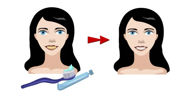 Chica Sonriente Cómo Cepillarte Los Dientes Los Dientes Amarillos Vuelven — Vector de stock