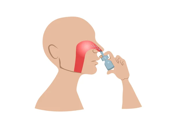 鼻腔喷雾器 一个正在治疗流鼻涕的人的特征 — 图库矢量图片