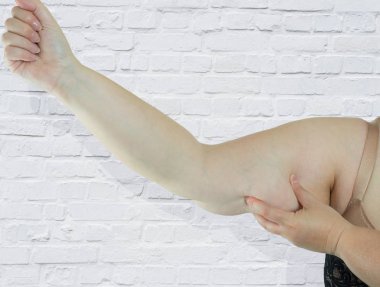 Etkilenen vücut parçaları gösterilen obezite kadınla