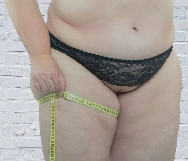 Женщина с ожирением показывает пораженные части тела — стоковое фото